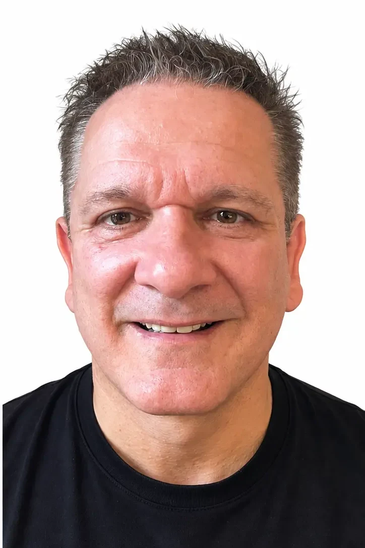 After facial rejuvenation